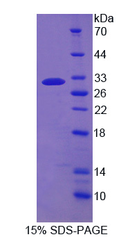 CD226分子(CD226)重组蛋白,Recombinant Cluster Of Differentiation 226 (CD226)