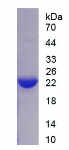 CD247分子(CD247)重组蛋白,Recombinant Cluster Of Differentiation 247 (CD247