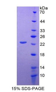 CD276分子(CD276)重组蛋白,Recombinant Cluster Of Differentiation 276 (CD276)