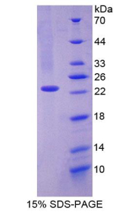 CD27结合蛋白(CD27BP)重组蛋白,Recombinant CD27 Binding Protein (CD27BP)