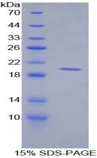 CD30配体(CD30L)重组蛋白,Recombinant Cluster Of Differentiation 30 Ligand (CD30L)