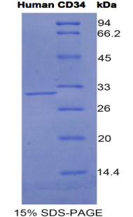 CD34分子(CD34)重组蛋白,Recombinant Cluster Of Differentiation 34 (CD34