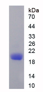 CD3d分子(CD3d)重組蛋白,Recombinant Cluster Of Differentiation 3d (CD3d)