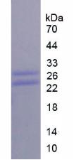 CD8a分子(CD8a)重组蛋白,Recombinant Cluster Of Differentiation 8a (CD8a)