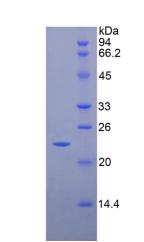 CD8b分子(CD8b)重组蛋白,Recombinant Cluster Of Differentiation 8b (CD8b)