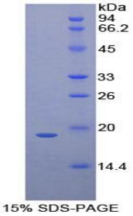 CD97分子(CD97)重组蛋白,Recombinant Cluster Of Differentiation 97 (CD97)