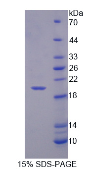 CD99分子(CD99)重组蛋白,Recombinant Cluster Of Differentiation 99 (CD99)