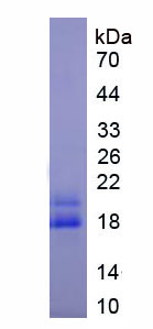 Cereblon蛋白(CRBN)重组蛋白,Recombinant Cereblon (CRBN)