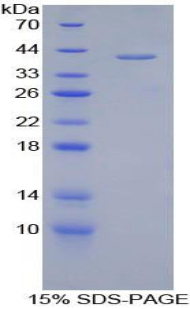 Corin蛋白(CRN)重組蛋白,Recombinant Corin (CRN)