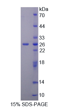 CUB域EGF样信号肽3(SCUBE3)重组蛋白,Recombinant Signal Peptide, CUB Domain, EGF Like 3 (SCUBE3)