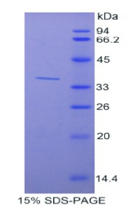 CutC铜转运蛋白(CUTC)重组蛋白,Recombinant CutC Copper Transporter (CUTC)