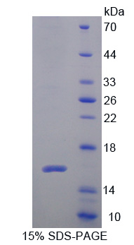 Cytospin B蛋白(CYTSB)重组蛋白,Recombinant Cytospin B (CYTSB)