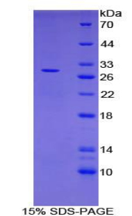 C-型凝集素域家族13成员A(CLEC13A)重组蛋白,Recombinant C-Type Lectin Domain Family 13, Member A (CLEC13A)