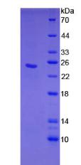 C-型凝集素域家族4成員C(CLEC4C)重組蛋白,Recombinant C-Type Lectin Domain Family 4, Member C (CLEC4C)