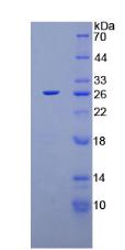 C組著色性干皮病偶聯(lián)因子(XPC)重組蛋白,Recombinant Xeroderma Pigmentosum, Complementation Group C (XPC)