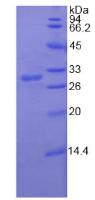 DEAD框肽5(DDX5)重组蛋白,Recombinant DEAD Box Polypeptide 5 (DDX5)