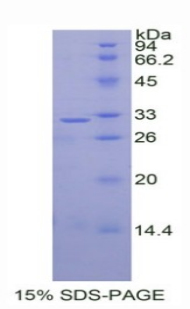 Dickkopf相关蛋白1(DKK1)重组蛋白,Recombinant Dickkopf Related Protein 1 (DKK1)