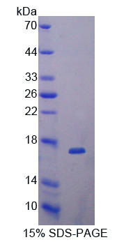 Dickkopf相關(guān)蛋白4(DKK4)重組蛋白,Recombinant Dickkopf Related Protein 4 (DKK4)