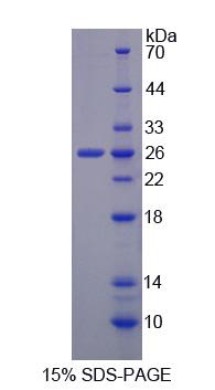 Discs大同源物3(DLG3)重組蛋白,Recombinant Discs, Large Homolog 3 (DLG3)