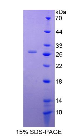 DnaJ/Hsp40同源物亚家族C成员12(DNAJC12)重组蛋白,Recombinant DnaJ/HSP40 Homolog Subfamily C, Member 12 (DNAJC12)