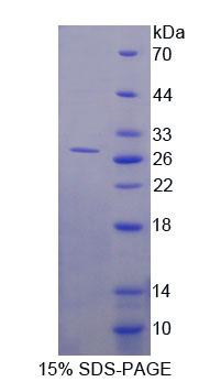DNA甲基转移酶3B(DNMT3B)重组蛋白,Recombinant DNA Methyltransferase 3B (DNMT3B)