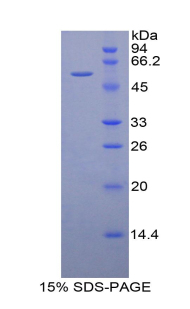 Duffy血型趨化因子受體(DARC)重組蛋白,Recombinant Duffy Blood Group Chemokine Receptor (DARC)