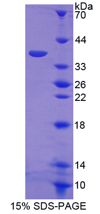 E1A结合蛋白P300(EP300)重组蛋白,Recombinant E1A Binding Protein P300 (EP300)