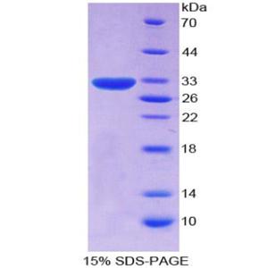 CD109分子(CD109)重组蛋白