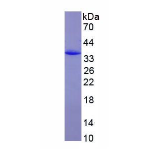 CD163分子(CD163)重组蛋白
