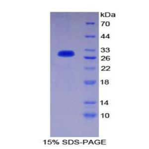 CD1d分子(CD1d)重组蛋白