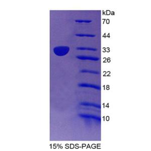 CD1e分子(CD1e)重组蛋白