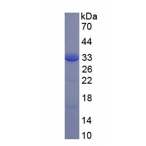 CD200受体1(CD200R1)重组蛋白