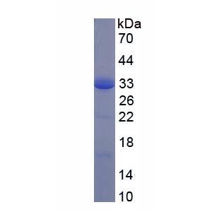 CD200受体1(CD200R1)重组蛋白,Recombinant CD200 Receptor 1 (CD200R1)