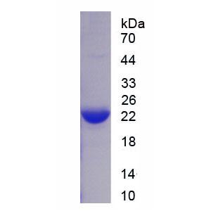 CD247分子(CD247)重组蛋白