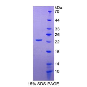 CD276分子(CD276)重组蛋白,Recombinant Cluster Of Differentiation 276 (CD276)