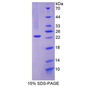 CD27结合蛋白(CD27BP)重组蛋白