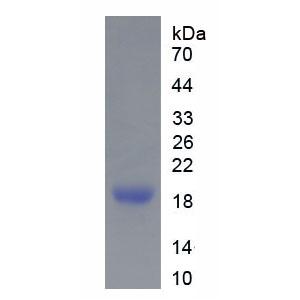 CD28分子(CD28)重组蛋白