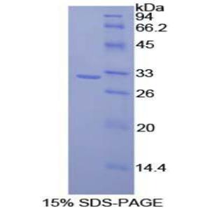 CD2关联蛋白(CD2AP)重组蛋白