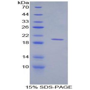 CD30配体(CD30L)重组蛋白,Recombinant Cluster Of Differentiation 30 Ligand (CD30L)