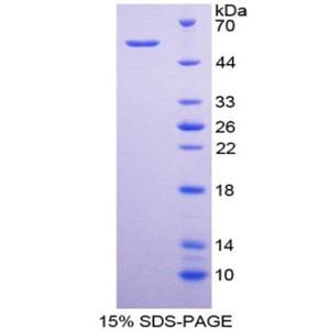 CD320分子(CD320)重组蛋白