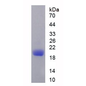 CD3d分子(CD3d)重组蛋白