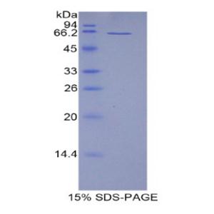 CD5抗原样蛋白(CD5L)重组蛋白,Recombinant CD5 Antigen Like Protein (CD5L)