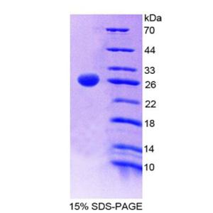 CD6分子(CD6)重组蛋白
