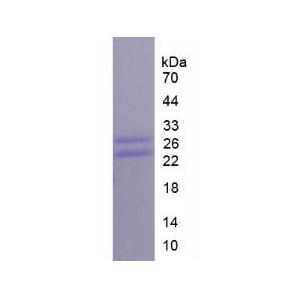 CD8a分子(CD8a)重组蛋白