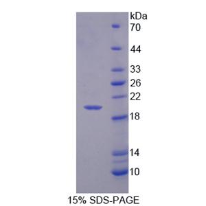 CD99分子(CD99)重组蛋白