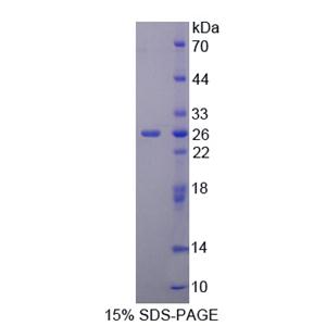 CUB域EGF样信号肽3(SCUBE3)重组蛋白