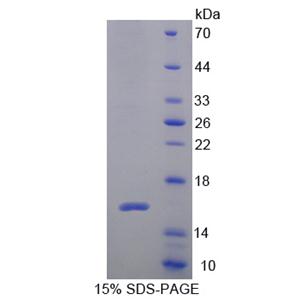 Cytospin B蛋白(CYTSB)重组蛋白,Recombinant Cytospin B (CYTSB)