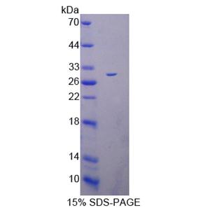 Deltex同源物1(DTX1)重组蛋白