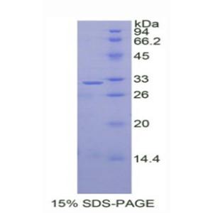Dickkopf相关蛋白1(DKK1)重组蛋白