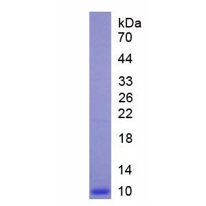 Dickkopf相关蛋白2(DKK2)重组蛋白